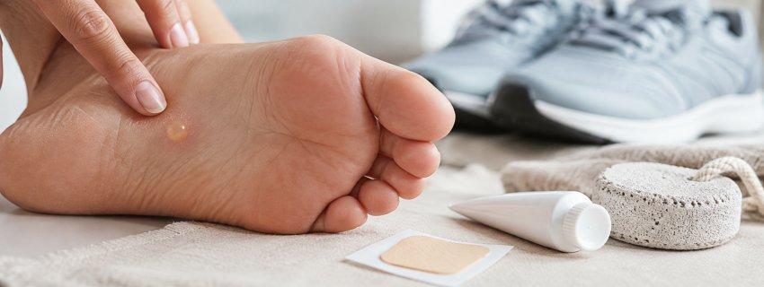 Beitragsbild 1 für den Beitrag: Hornhautblasen: Ursachen, Behandlung und Vorbeugung